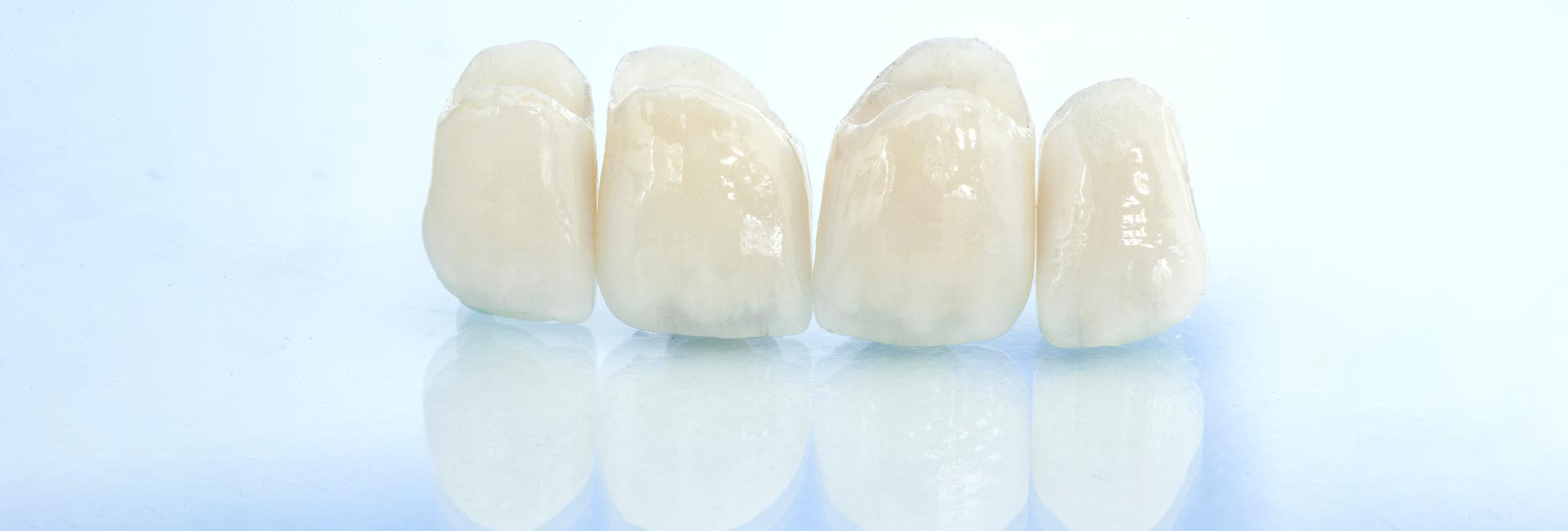 Dental Crowns & Bridges