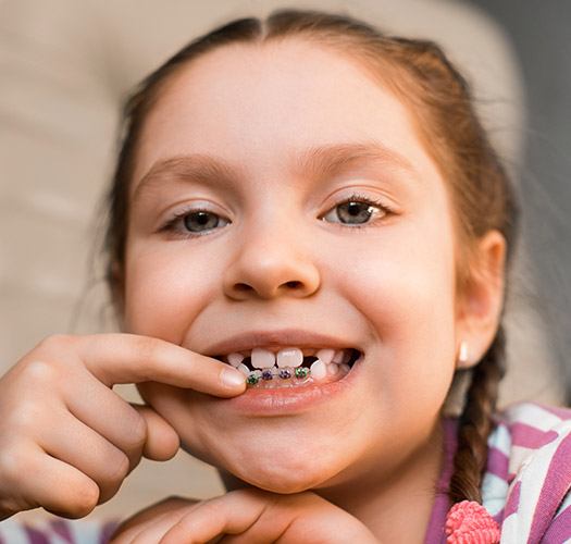 Phase 1 Orthodontics