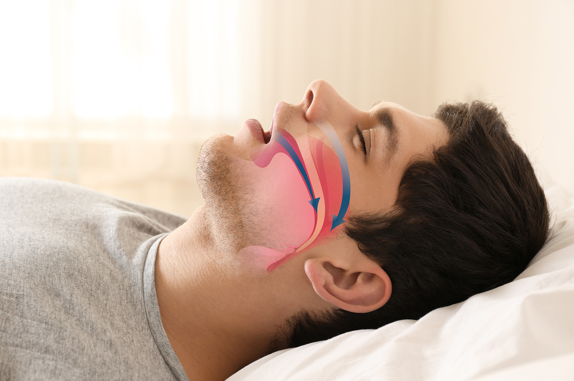 Signs You Have Sleep Apnea