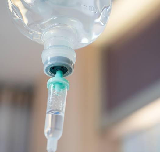 IV Sedation